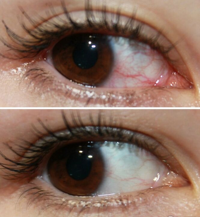 Ocuvit age muito rapidamente